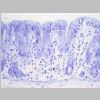 Intestino grueso SF 03.jpg
